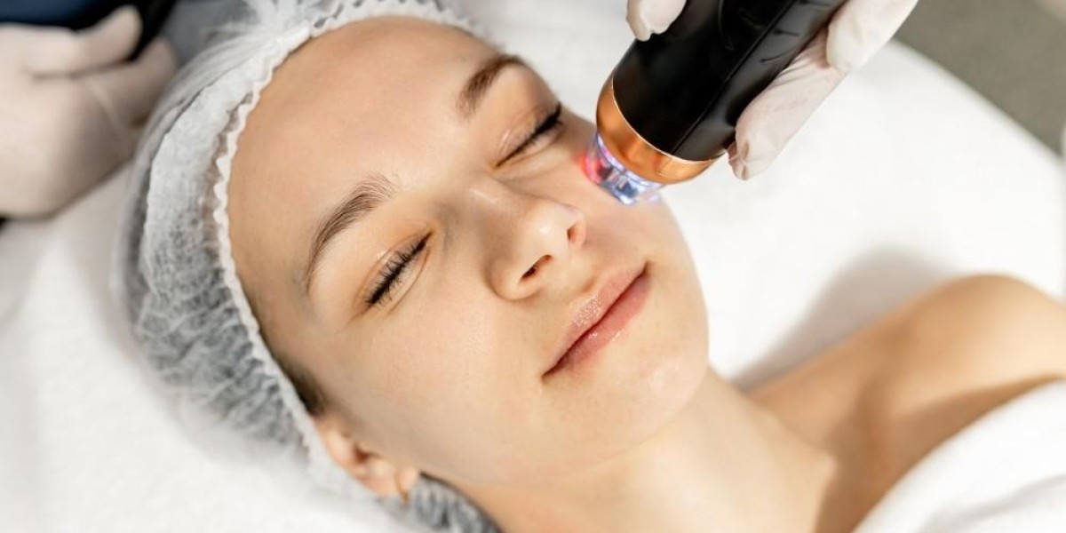 What Is Microneedling and How Does It Improve Skin?
