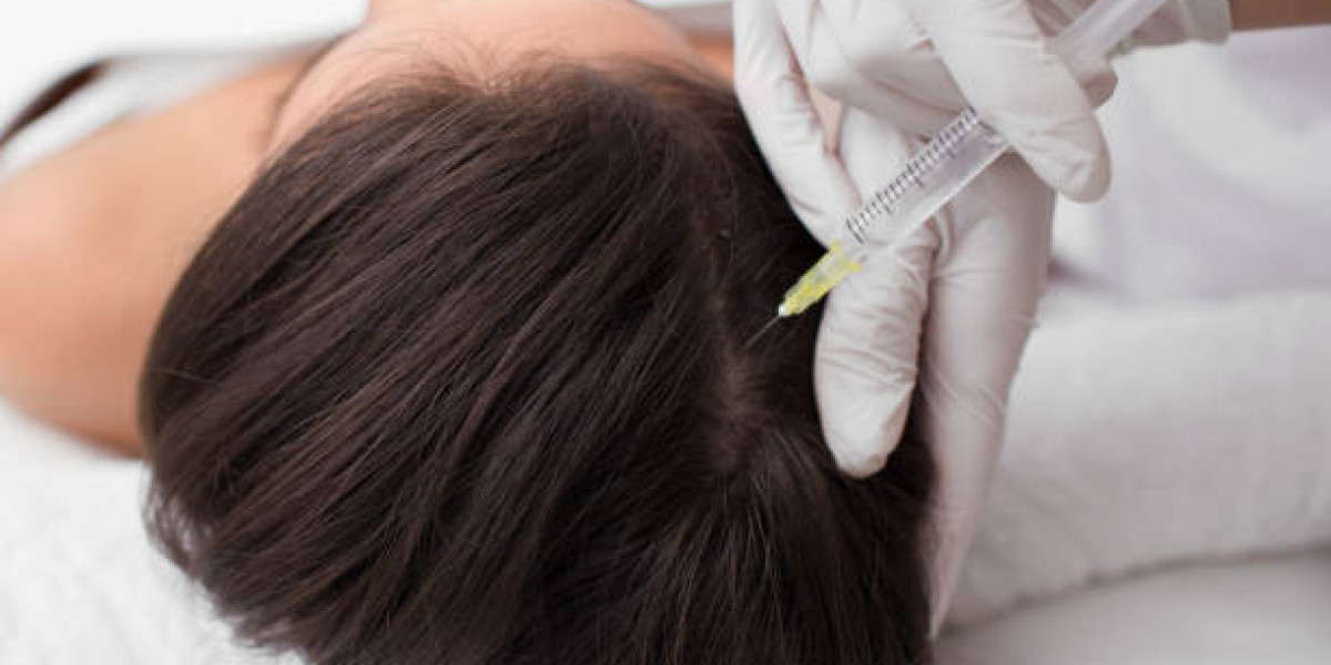 PRP Hair Treatment Reviews: User Stories of Hair Transformation