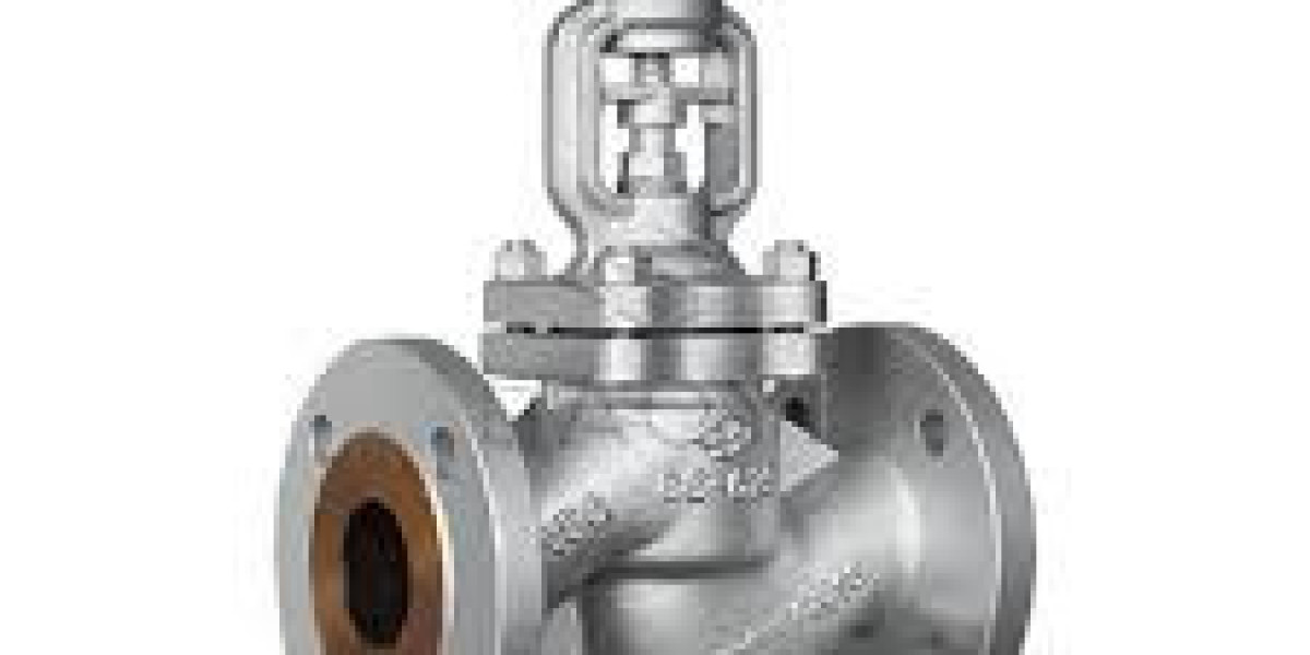 Will FY-valve Globe Valve Manufacturer Custom Development Shape Future Procurement?