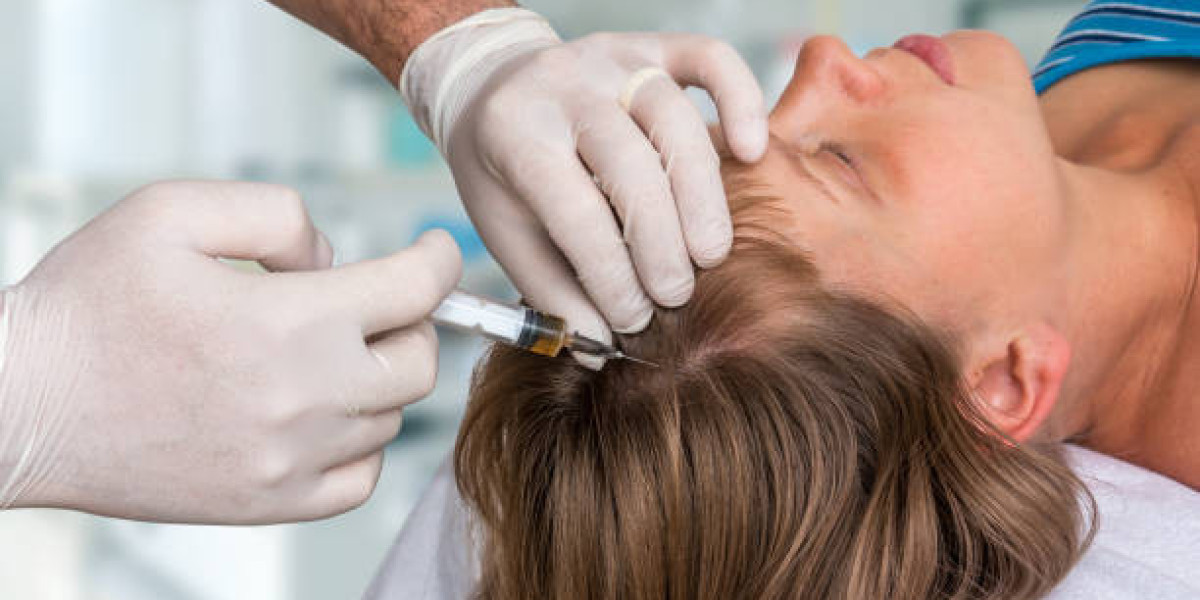 PRP Hair Treatment: Boosting Scalp Health and Hair Density