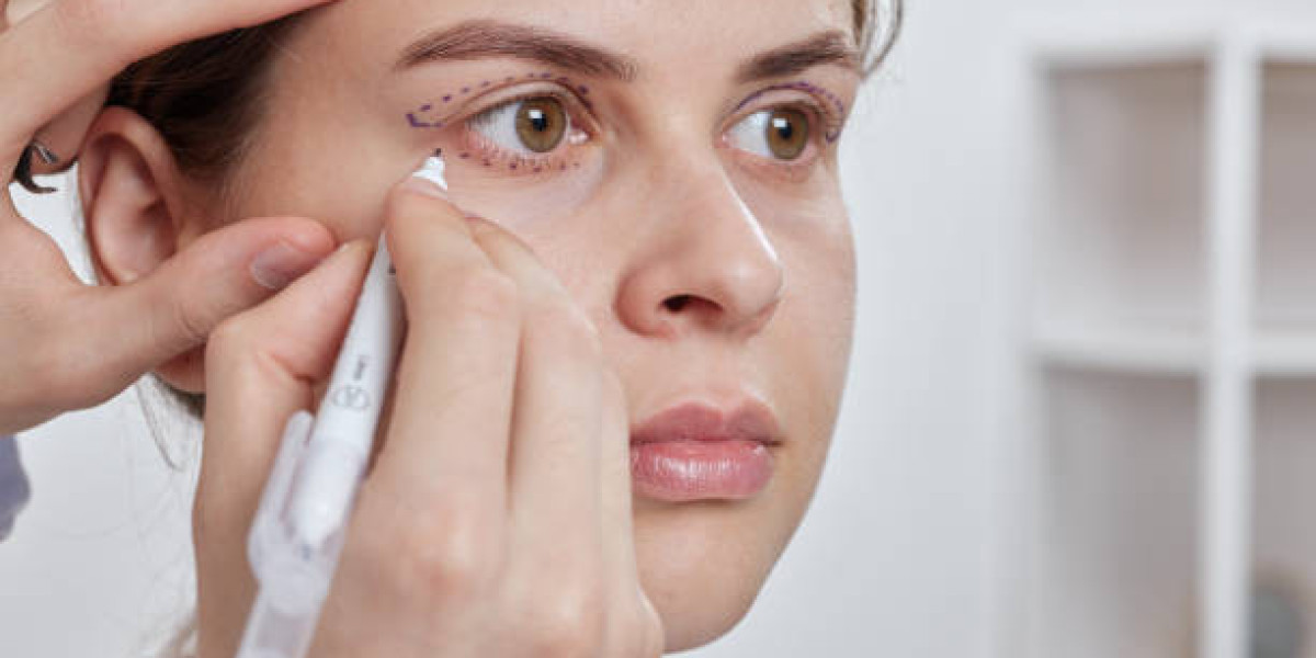 Eyelid Surgery in Riyadh: Safety, Expectations, and Post-Procedure Care