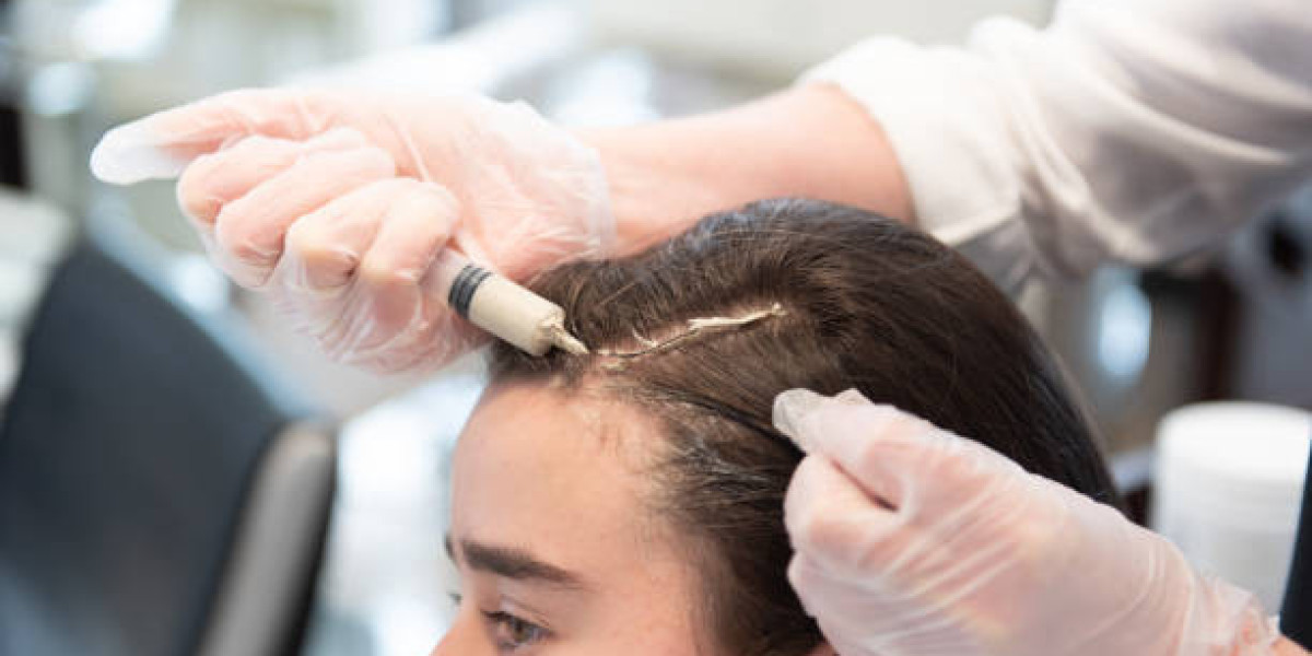 Banish Thinning Hair Naturally: PRP Treatment's Proven Mechanism