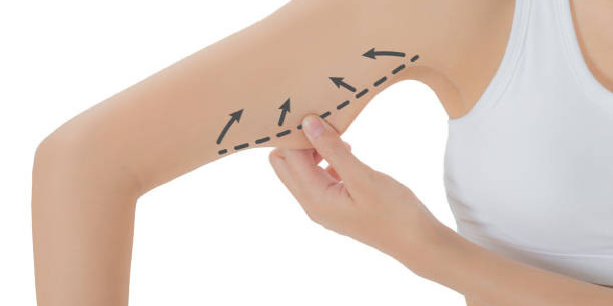 Arm Lift Surgery for Balanced and Proportional Arms