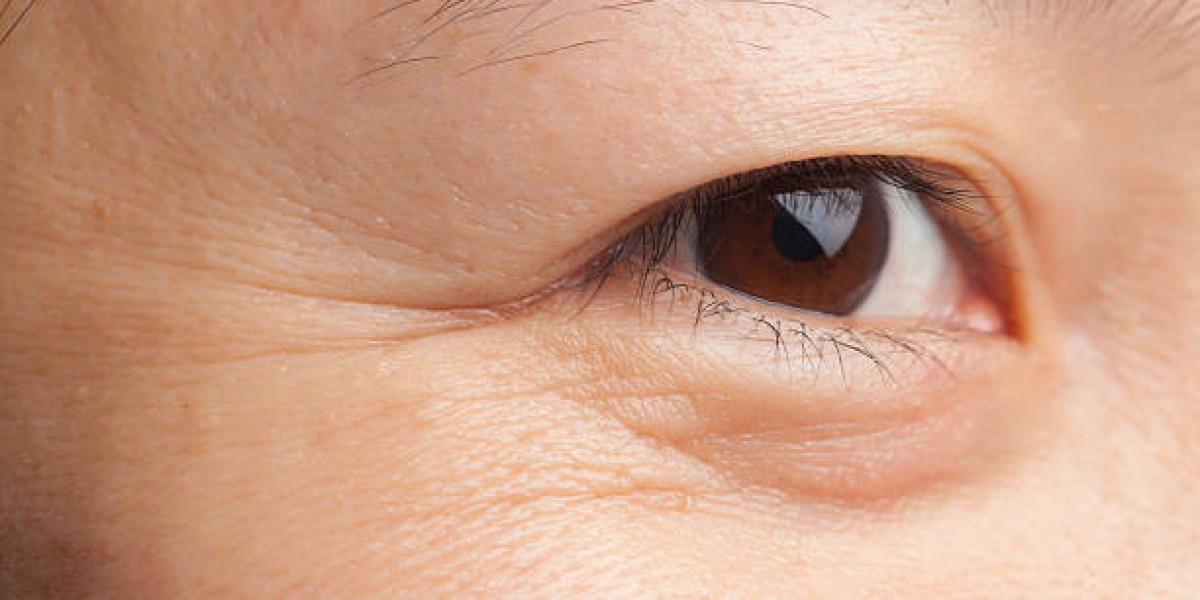 Youthful Eyes Post Eye Bag Removal: Sustaining Gains Through Daily Care