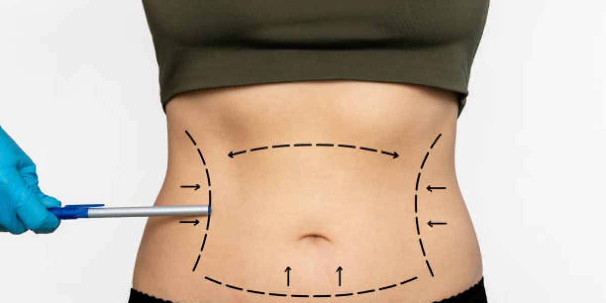 Liposuction Techniques and Their Impact on Body Contouring
