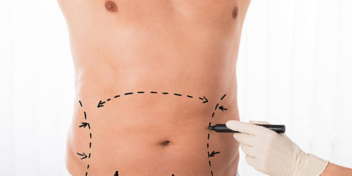 Fat Melting Injections for Chin Fat Reduction Goals