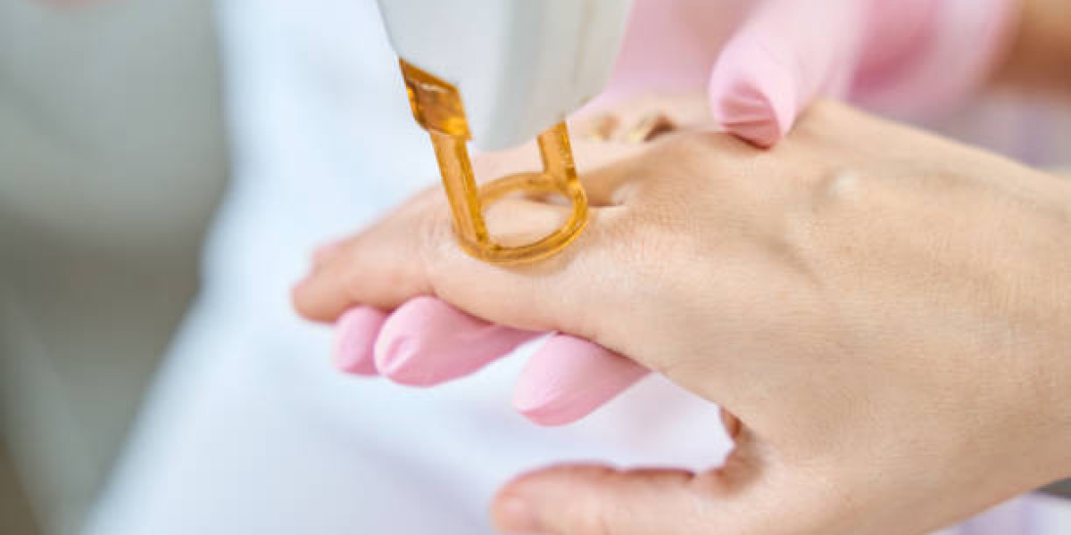 Pre-Treatment Prep for Optimal Electrolysis Hair Removal Outcomes