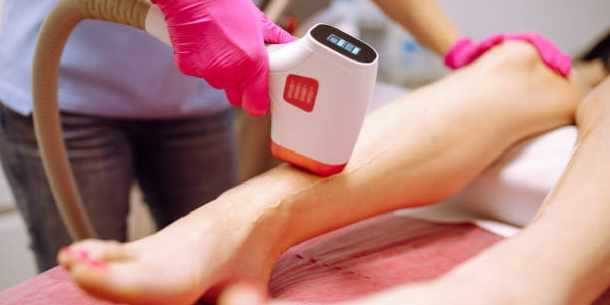 Laser Hair Removal Experience for Silky Smooth Skin