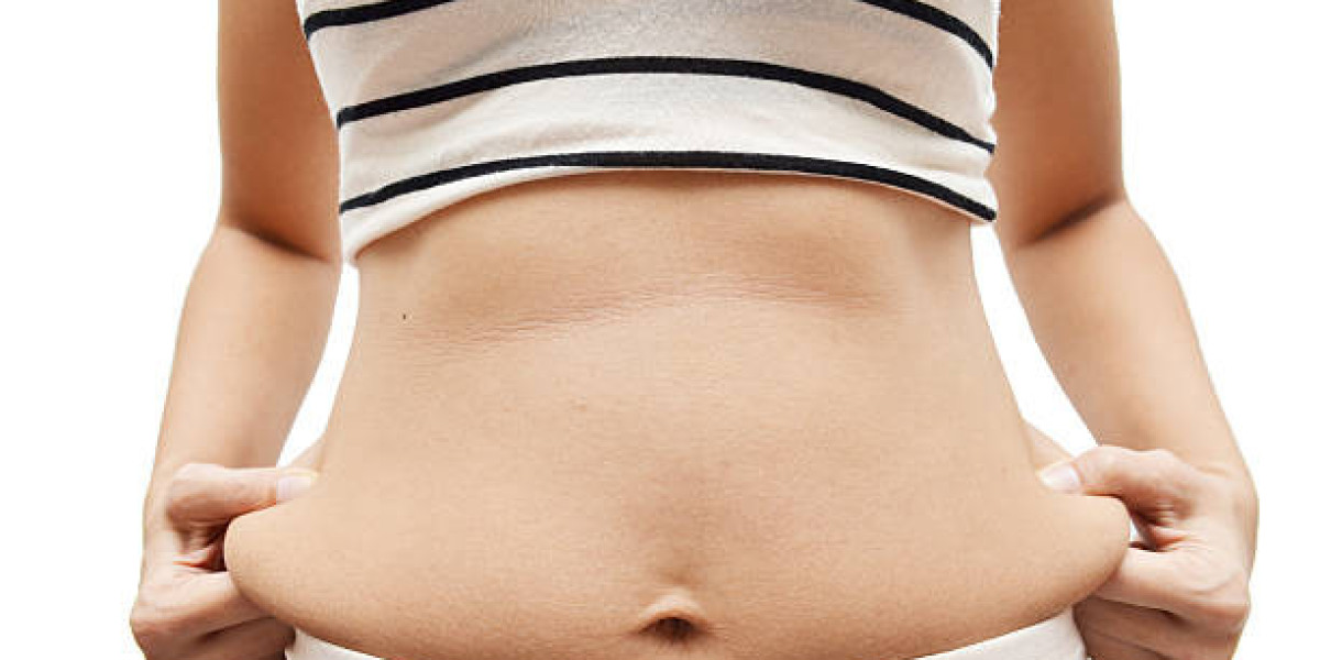 Tummy Tuck Revisions: When and Why They May Be Needed