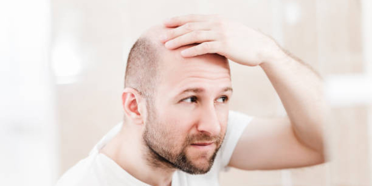 Natural looking results: hairline artistry in Turkish Hair Transplant procedures