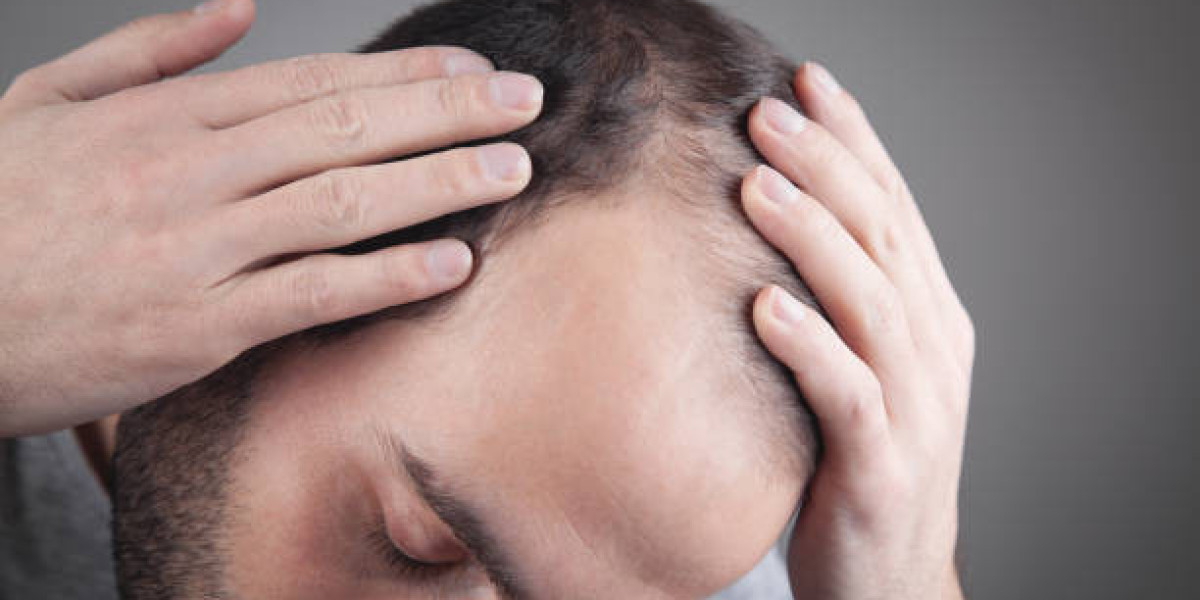 FShampoo Choices After FUE Hair Transplant: Gentle Care Guide