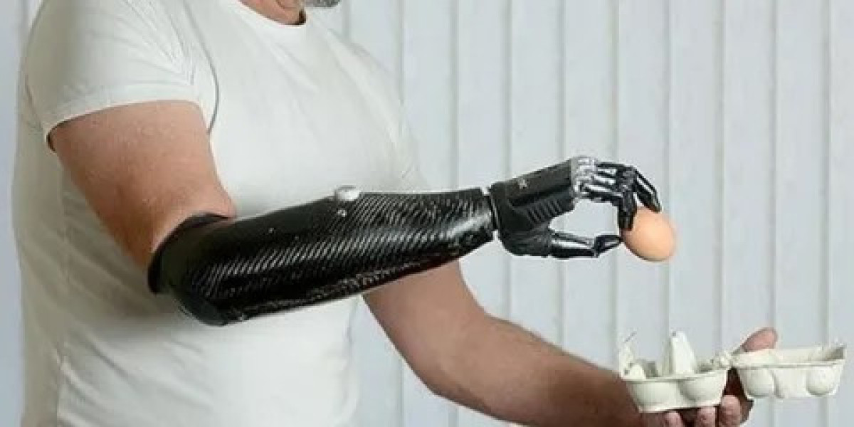 Carbon Fibre Composites Prosthetics Market: North America Leads as Össur, Ottobock, Fillauer Drive Advanced Mobility Sol