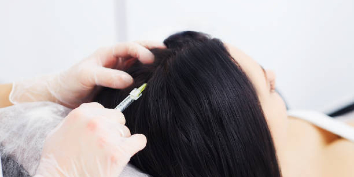 PRP Hair Treatment for Strong Hair Follicles