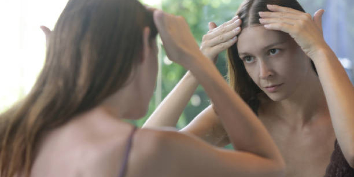 Hair Loss Treatment for Autoimmune-Related Loss