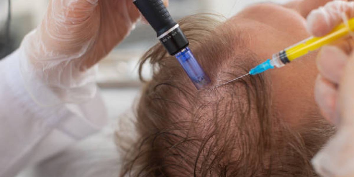 Before and After Exosome Hair Therapy in Islamabad: What Really Changes?