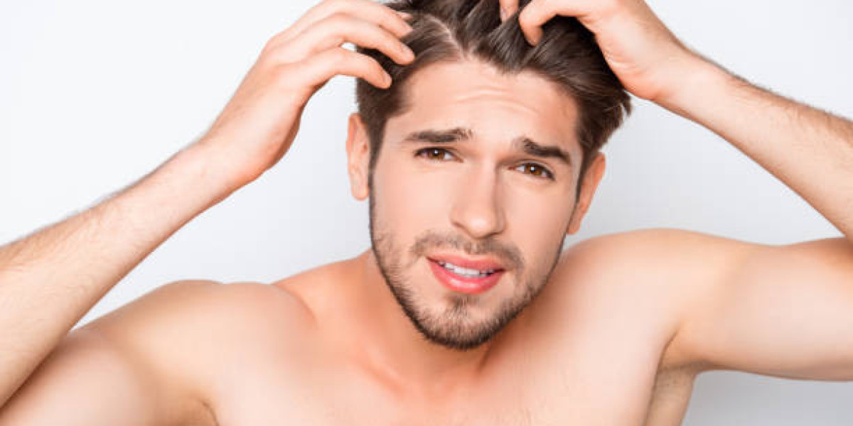 Post-FUE Hair Transplant Care: Best Practices for Optimal Healing