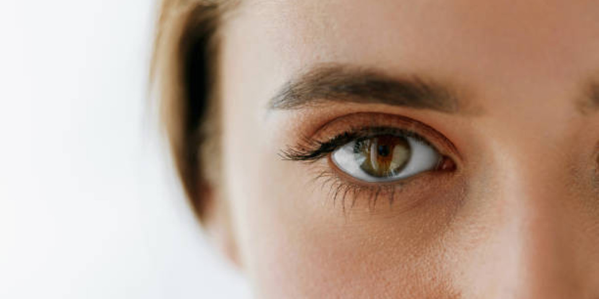 Eyelid Surgery for Under Eye Bags: Causes and Surgical Fixes