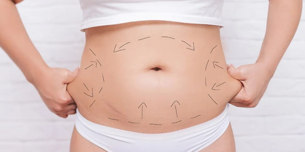 Best Clinics for Tummy Tuck Surgery in Islamabad