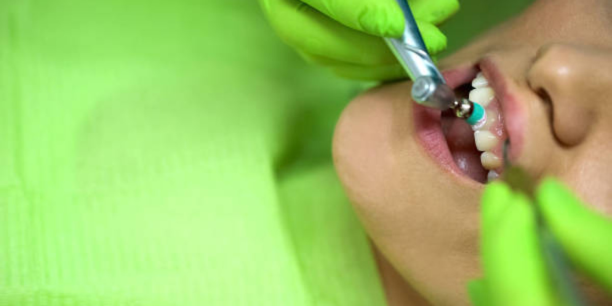 Why Teeth Scaling and Polishing Should Be Part of Your Regular Dental Routine