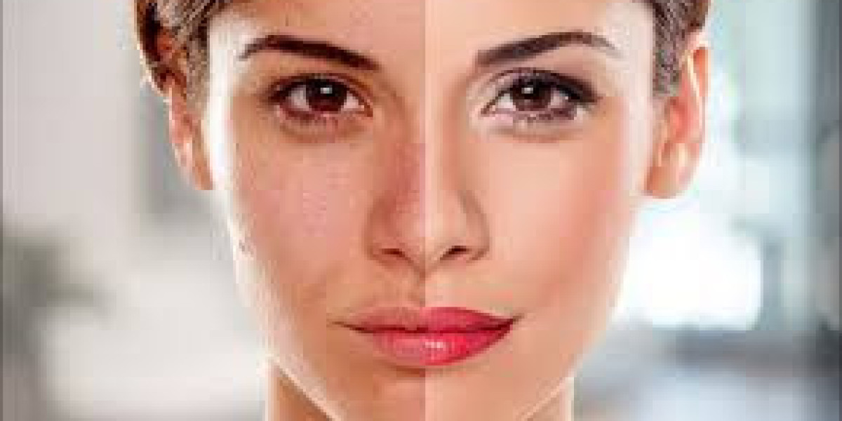How Skin Whitening Treatments Help Restore Clear, Radiant, and Youthful Skin