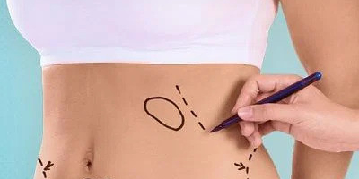Weight Loss Treatments in Islamabad – Discover a Healthier Version of Yourself