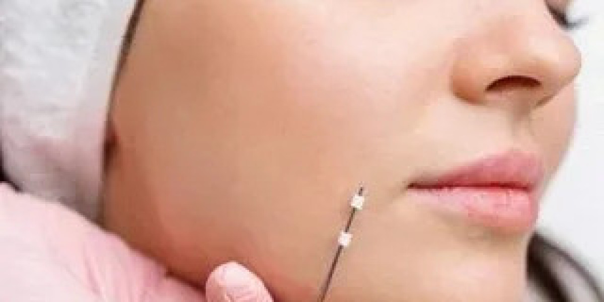 Thread Lift Treatments in Islamabad for Non-Surgical Facial Lifting, Skin Tightening, Collagen Stimulation and Natural A