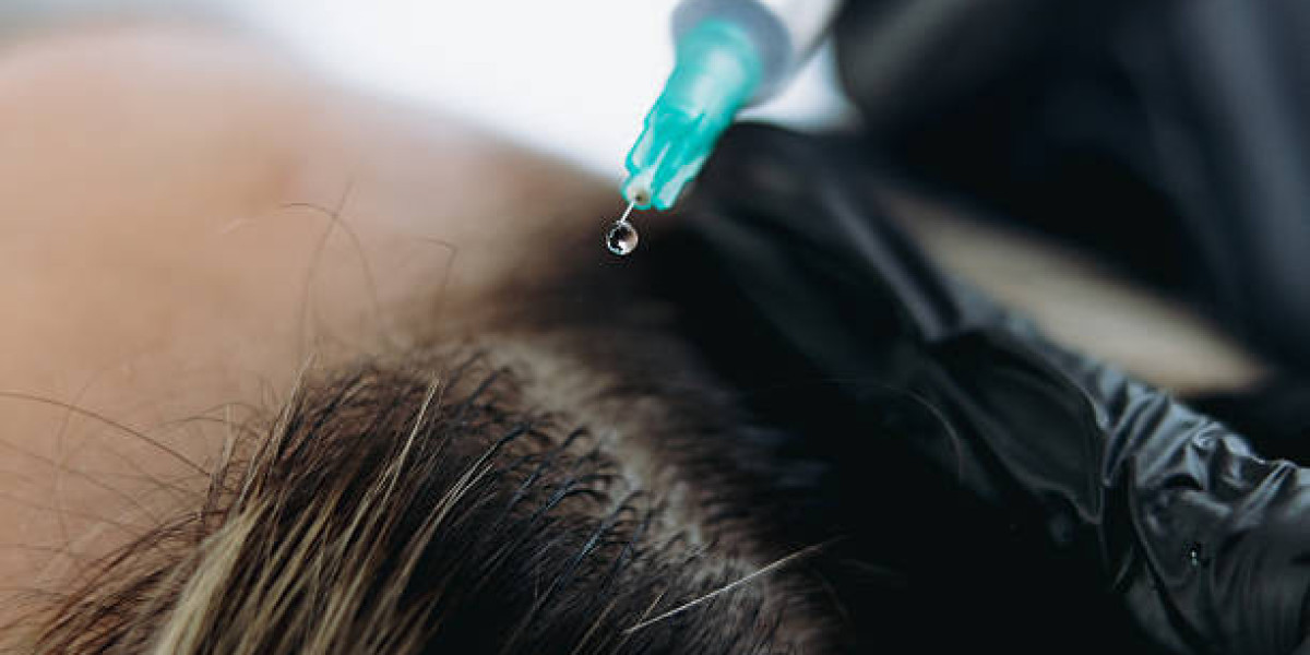 Exosome Hair in Dubai: Targeted Solutions for Thinning