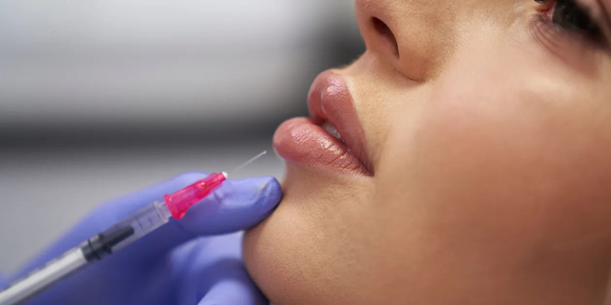 Lip Filler in Islamabad – The Secret to Fuller and More Defined Lips