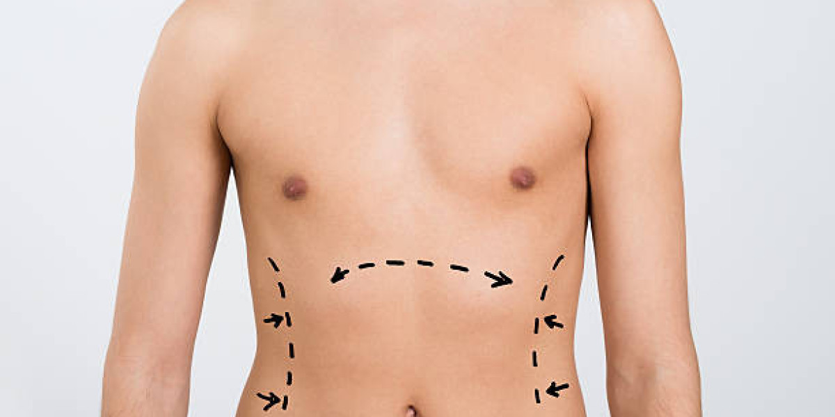 A Trusted Way to Achieve a More Defined and Beautiful Body