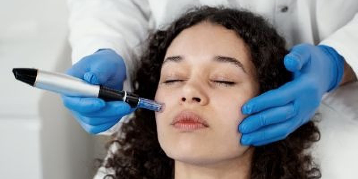Microneedling in Islamabad – Restore Your Skin’s Natural Beauty