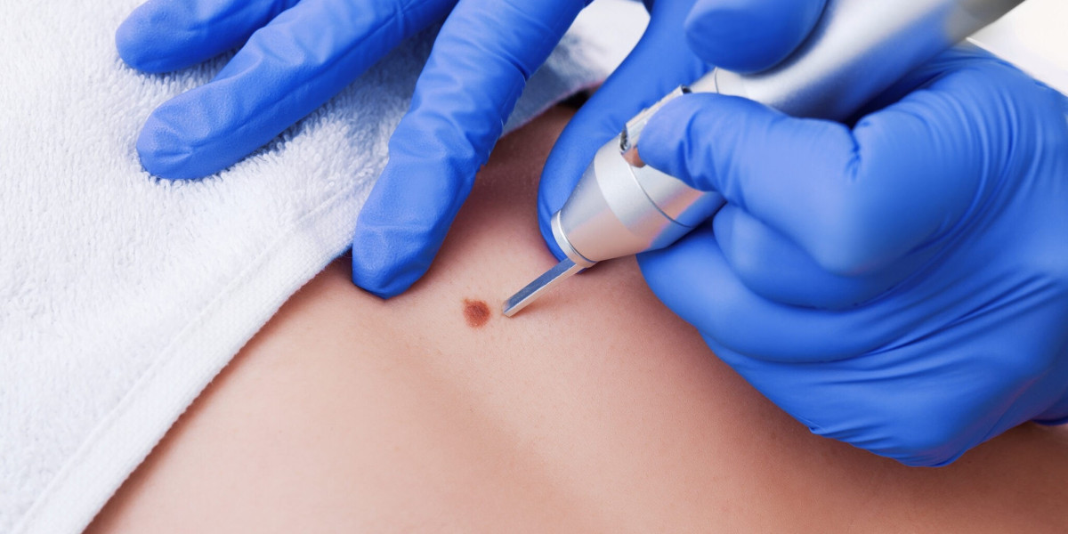Does Mole Removal Leave Scars?