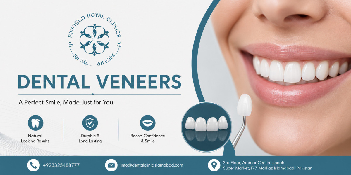 Dental Veneers in Islamabad: A Modern Cosmetic Dentistry Solution