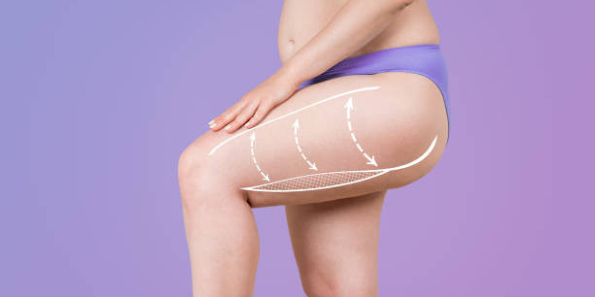 Where to Learn About Buttock Augmentation in Dubai Results
