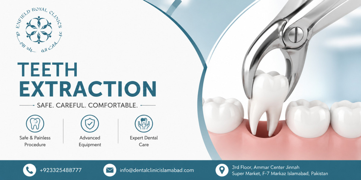 Reliable Teeth Extraction in Islamabad for Better Oral Health