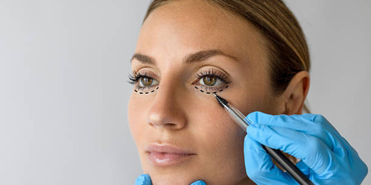 Top Results You Can Expect From Blepharoplasty Dubai Treatment