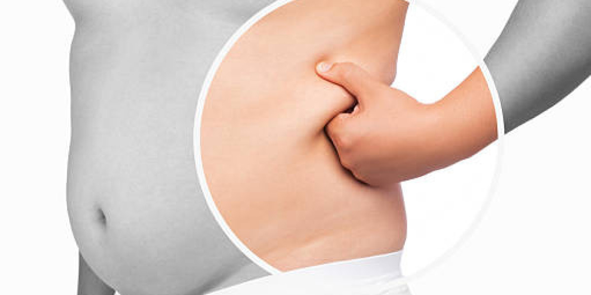 What Makes Vaser Quad Liposuction in Dubai Different?