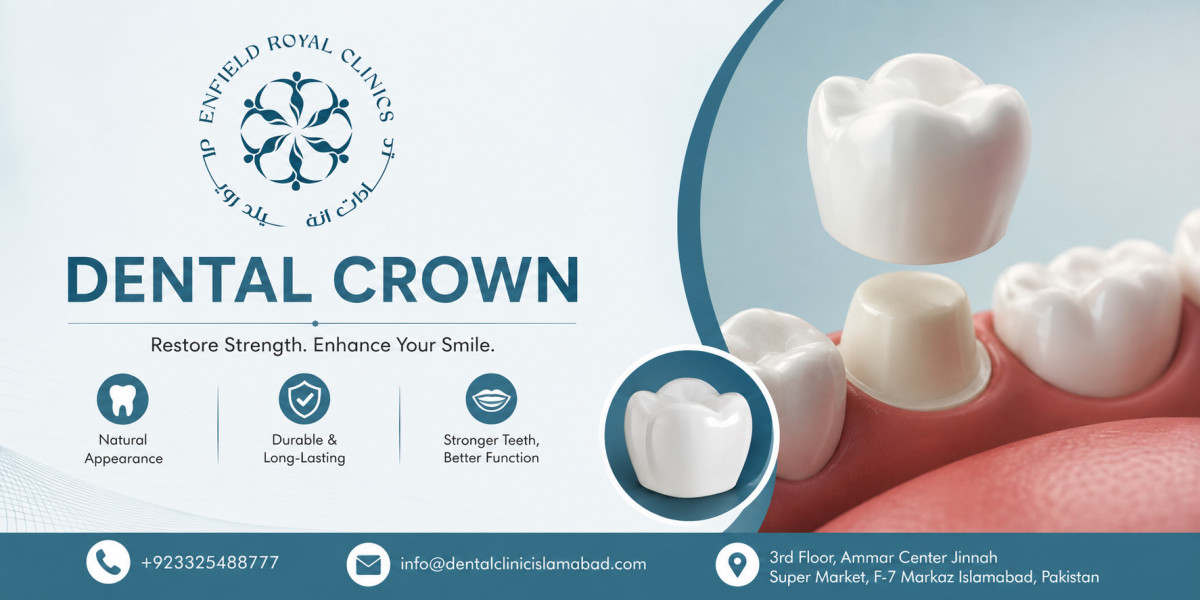Professional Dental Crown Services in Islamabad